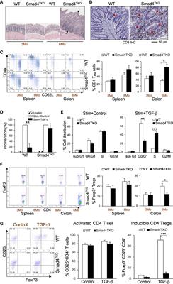 Smad4-deficient T cells promote colitis-associated colon cancer via an IFN-γ-dependent suppression of 15-hydroxyprostaglandin dehydrogenase